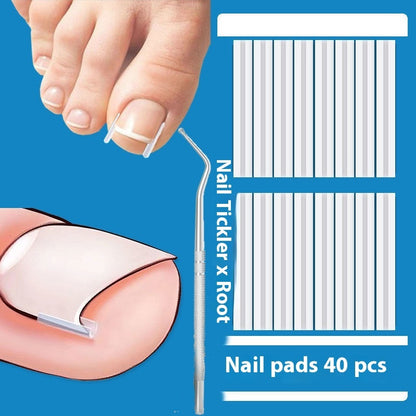 Groove Nail Braces Ingrowth Isolation Filling Gasket